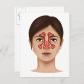 Anatomie van sinussen van de nieren briefkaart (Voorkant / Achterkant)