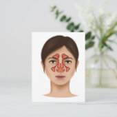 Anatomie van sinussen van de nieren briefkaart (Staand voorkant)