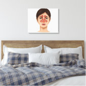 Anatomie van sinussen van de nieren canvas afdruk (Insitu (Slaapkamer))