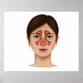 Anatomie van sinussen van de nieren poster (Voorkant)