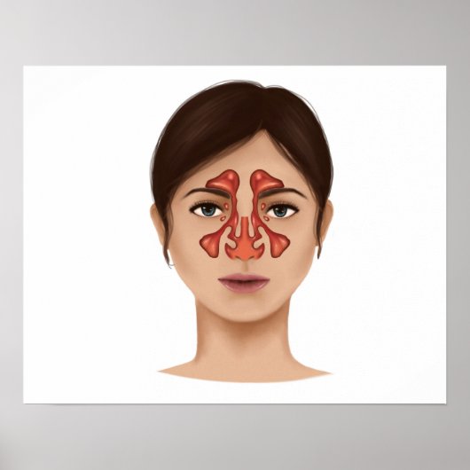 Anatomie van sinussen van de nieren poster (Voorkant)