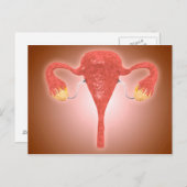 Anatomie van Vrouw baarmoeder met eierstokken Briefkaart (Voorkant / Achterkant)