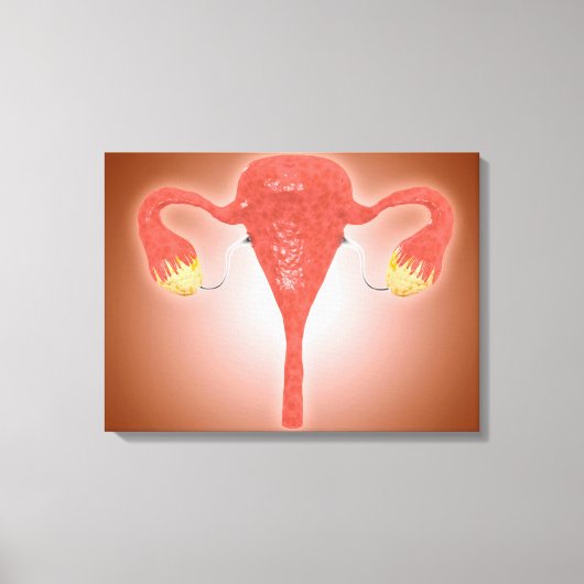Anatomie van Vrouw baarmoeder met eierstokken Canvas Afdruk (Voorkant)