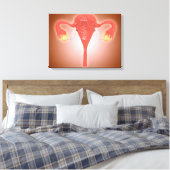 Anatomie van Vrouw baarmoeder met eierstokken Canvas Afdruk (Insitu (Slaapkamer))