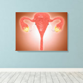 Anatomie van Vrouw baarmoeder met eierstokken Canvas Afdruk (Insitu (Houten vloer))