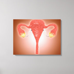 Anatomie van Vrouw baarmoeder met eierstokken Canvas Afdruk