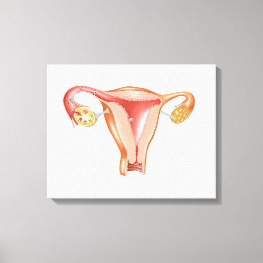 Anatomie van Vrouw Uterus 1 Canvas Afdruk (Voorkant)