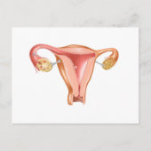 Anatomie van Vrouwelijke Baarmoeder 1 Briefkaart (Voorkant)