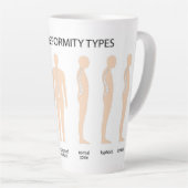 Anatomie van wervelkolommisvorming latte mok (Rechterhoek)