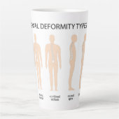 Anatomie van wervelkolommisvorming latte mok (Voorkant)