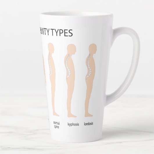 Anatomie van wervelkolommisvorming latte mok (Rechts)