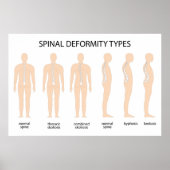 Anatomie van wervelkolommisvorming poster (Voorkant)