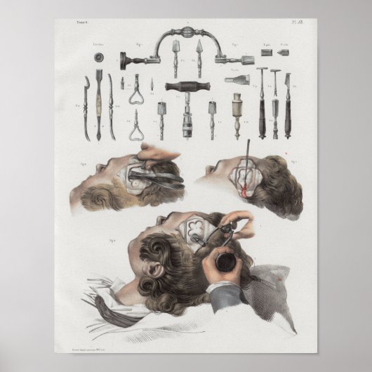anatomieafdrukken van hersenchirurgische instrume poster (Voorkant)