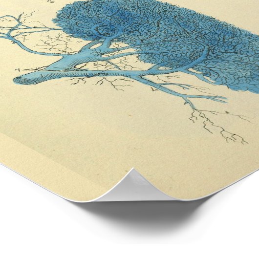  anatomieart van de galblaas van de lever poster (Hoek)