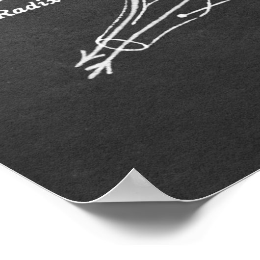 Anatomigenkaart van het ruggenmerg Afdrukken nr.3 Poster (Hoek)