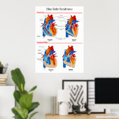 Anatomisch hartdiagram van blauw Baby syndroom Poster (Thuiskantoor)