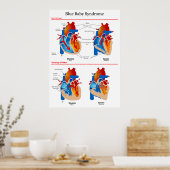 Anatomisch hartdiagram van blauw Baby syndroom Poster (Keuken)