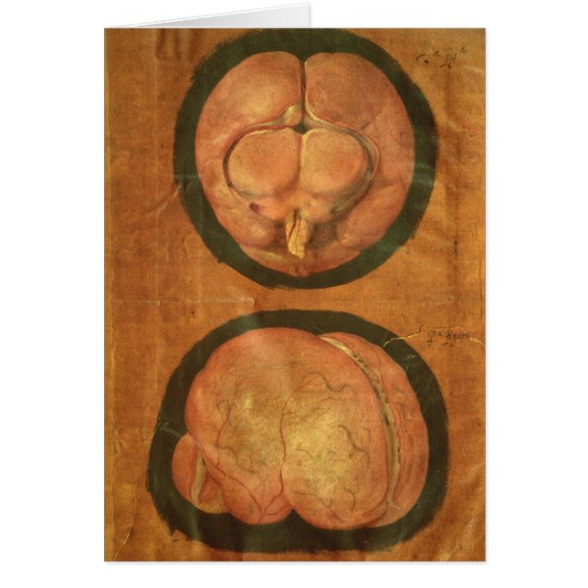 Anatomische tekening van het menselijk brein (Voorkant)