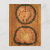 Anatomische tekening van het menselijk brein briefkaart (Voorkant)