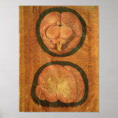Anatomische tekening van het menselijk brein poster (Voorkant)