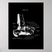 Ankle Anatomie Orthopedic Wall Decor Poster (Voorkant)