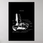 Ankle Joint Anatomy Orthopedic Decor Poster (Voorkant)