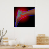 Ankle Pain Poster (Keuken)