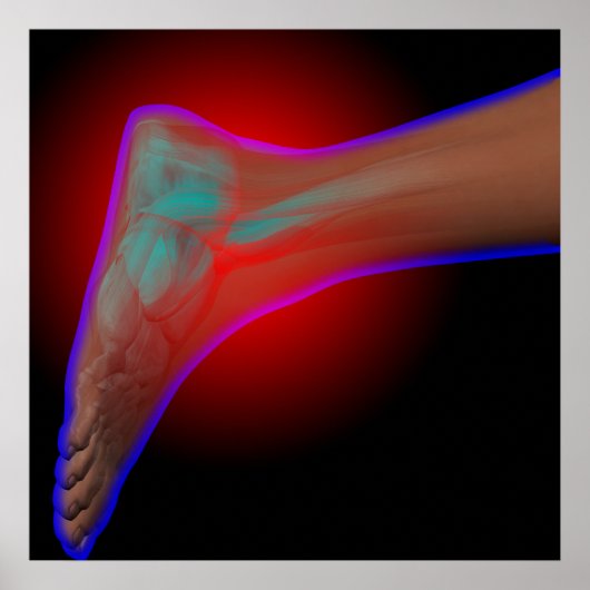 Ankle Pain Poster (Voorkant)