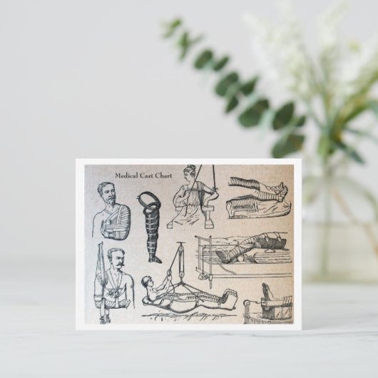 Antiek medische gietvormen grafiek briefkaart (Staand voorkant)
