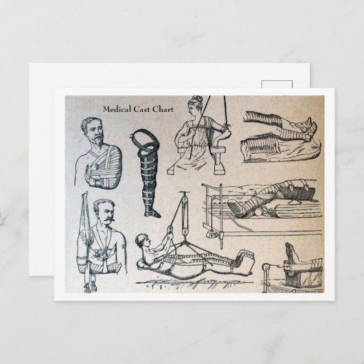 Antiek medische gietvormen grafiek briefkaart (Voorkant / Achterkant)