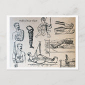 Antiek medische gietvormen grafiek briefkaart (Voorkant)