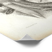 Antiek nekschouderspieren Medische druk Poster (Hoek)