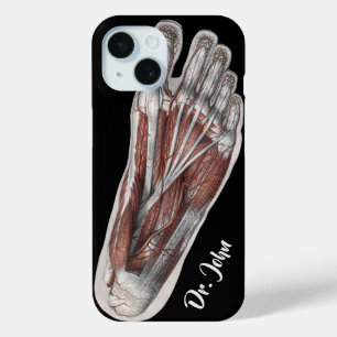 Antieke menselijke anatomie voetafdruk podiatrie v iPhone 15 case