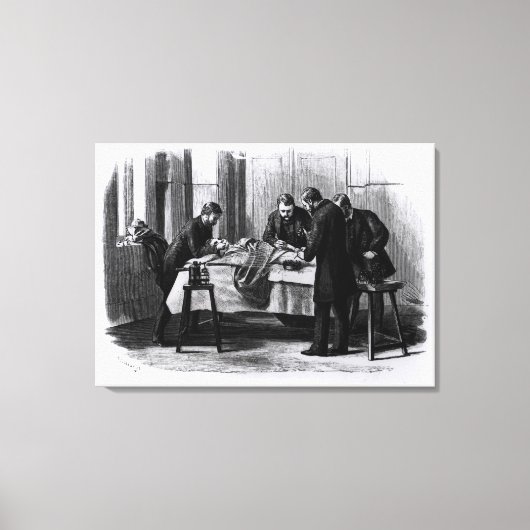 Antiseptische chirurgie, 1882 canvas afdruk (Voorkant)