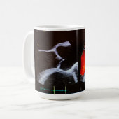 Aortaklep doppler echocardiogram cup koffiemok (Voorkant links)