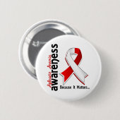 Aplastische anemie Bewustheid 5 Ronde Button 5,7 Cm (Voorkant /achterkant)