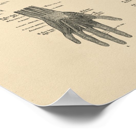 arm Nerves Anatomy 1880 Print (Hoek)