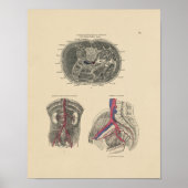  arterieanatomie 1880 afdrukken poster (Voorkant)