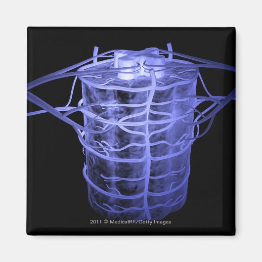 Arteriën rond een deel van de wervelkolom magneet (Voorkant)