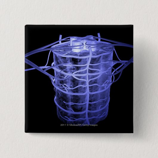 Arteriën rond een deel van de wervelkolom vierkante button 5,1 cm (Voorkant)