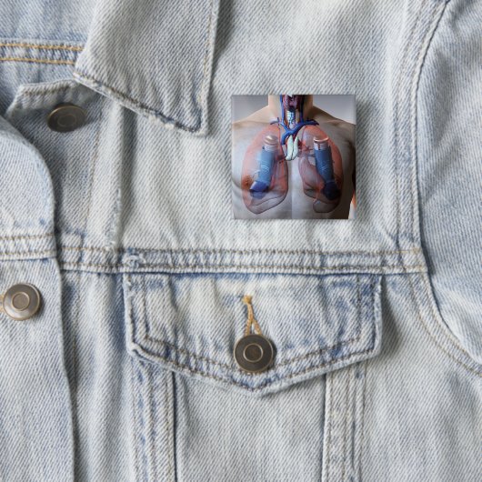 astma vierkante button 5,1 cm (In situ)