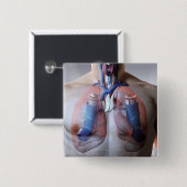 astma vierkante button 5,1 cm (Voorkant /achterkant)