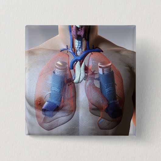 astma vierkante button 5,1 cm (Voorkant)