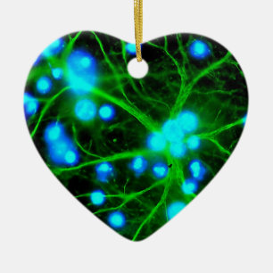 Astrocyte zijn stervormige gal cellen in de hersen keramisch ornament