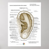 Auriculotherapy Ear Acupuncture Poster (Voorkant)