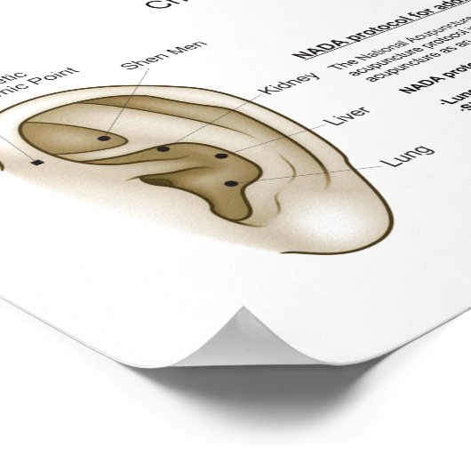 Auriculotherapy Ear Acupuncture Poster (Hoek)