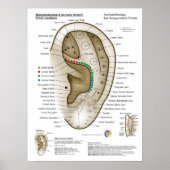 Auriculotherapy Ear Acupuncture Poster (Voorkant)