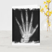 B&W de Hand van het Skelet van de röntgenstraal Kaart (Gele Bloem)