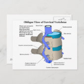 Baarwerende wervel van de menselijke wervelkolom briefkaart (Voorkant / Achterkant)