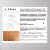 Babesia Symptomen en Poster van overdracht (Voorkant)